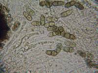 Pezoloma ciliifera image