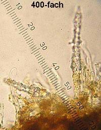 Rhizochaete filamentosa image