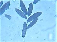 Navicella pileata image