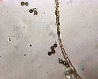 Schenella microspora image