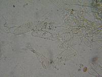 Coprinopsis cinerea image