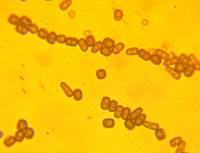 Thuemenella cubispora image