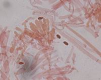 Tylopilus porphyrosporus image