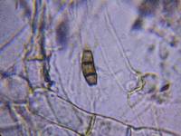 Hypomyces aurantius image