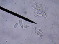 Hypomyces aurantius image