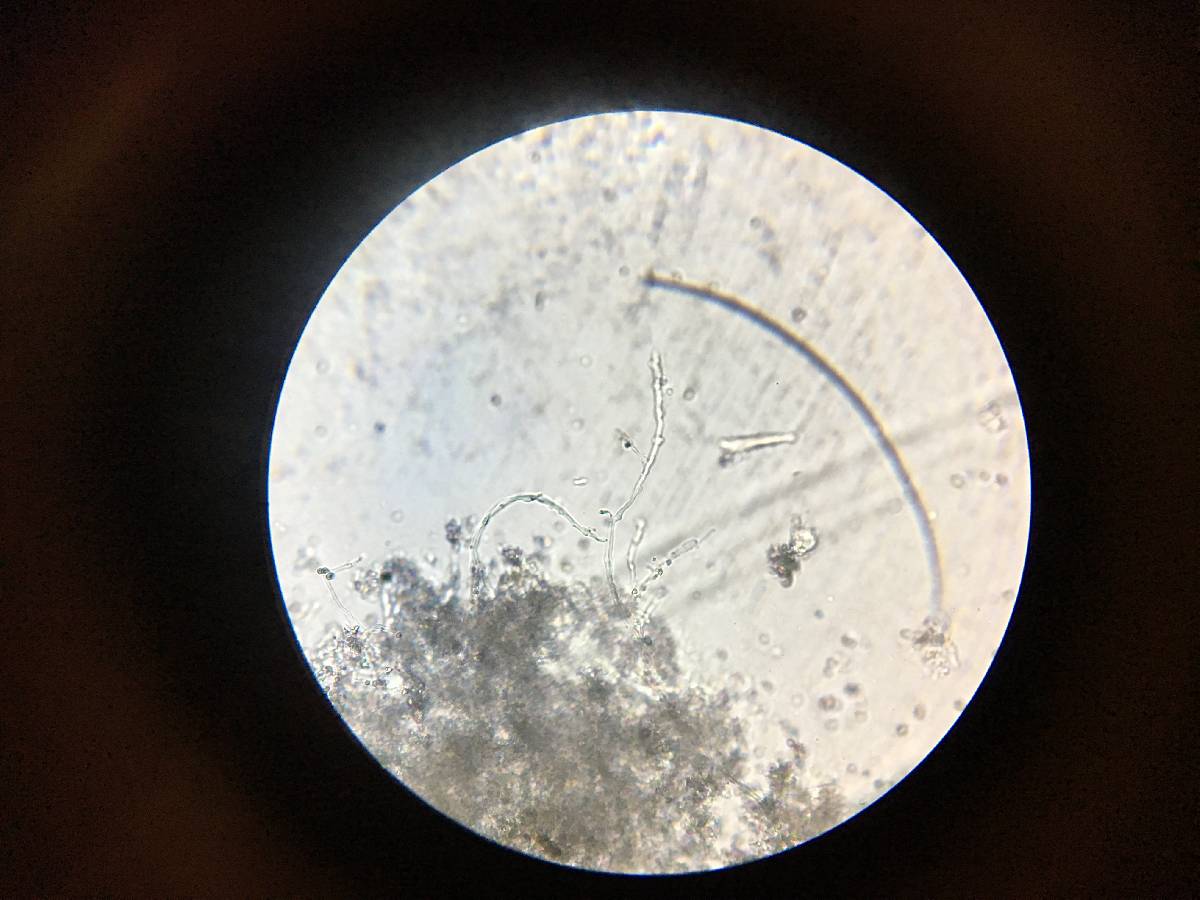Lyomyces juniperi image