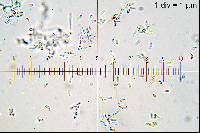 Ascocoryne cylichnium image