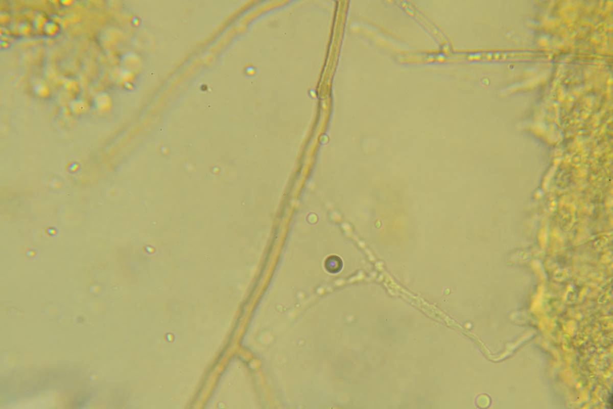 Sistotrema muscicola image