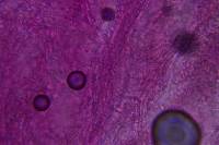 Hyphodontia arguta image