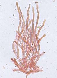 Hyphodontia quercina image