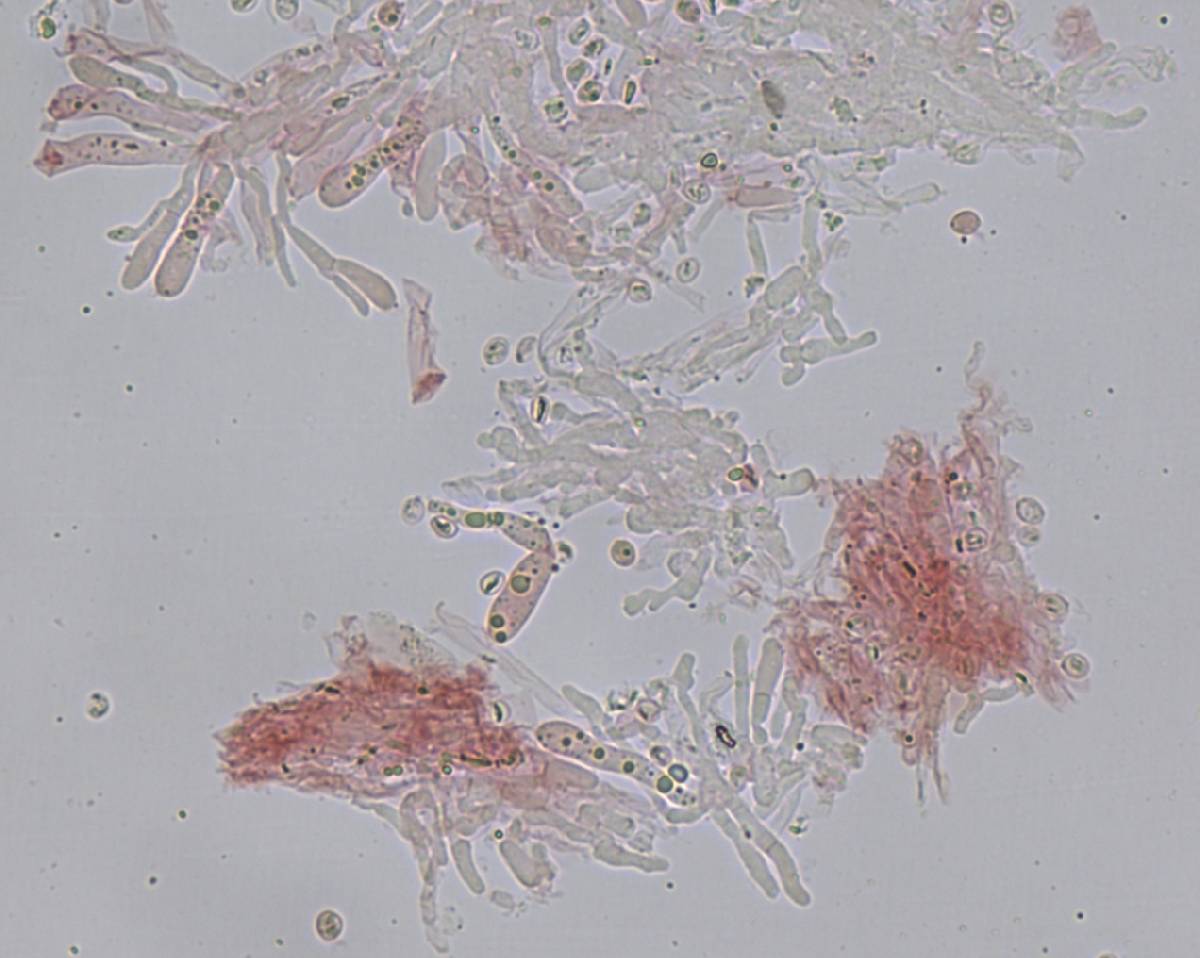 Conferticium ravum image