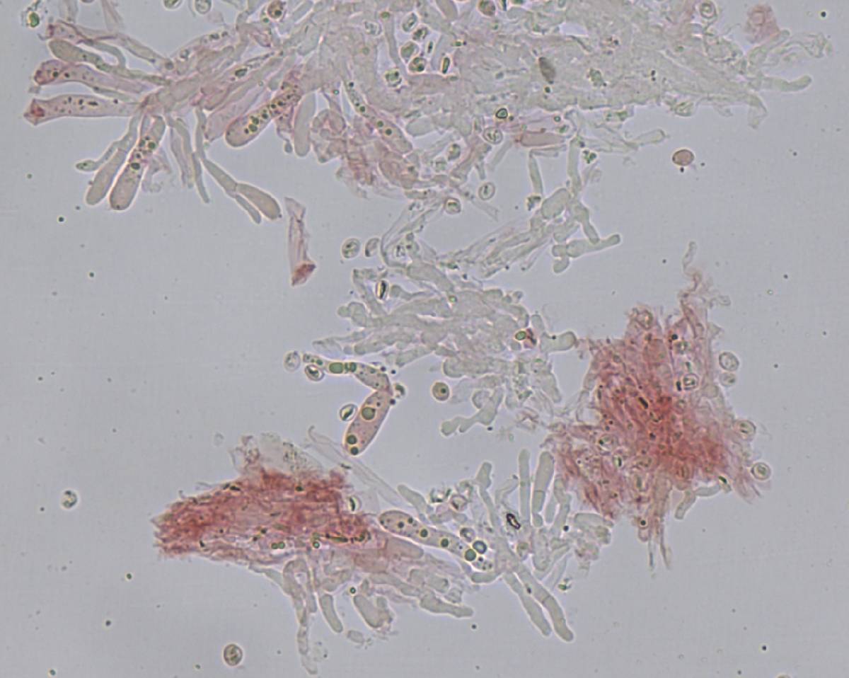 Conferticium ravum image