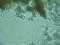 Acanthobasidium penicillatum image