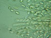 Rutstroemia conformata image