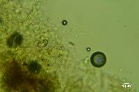 Sistotrema octosporum image