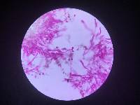 Corticium meridioroseum image