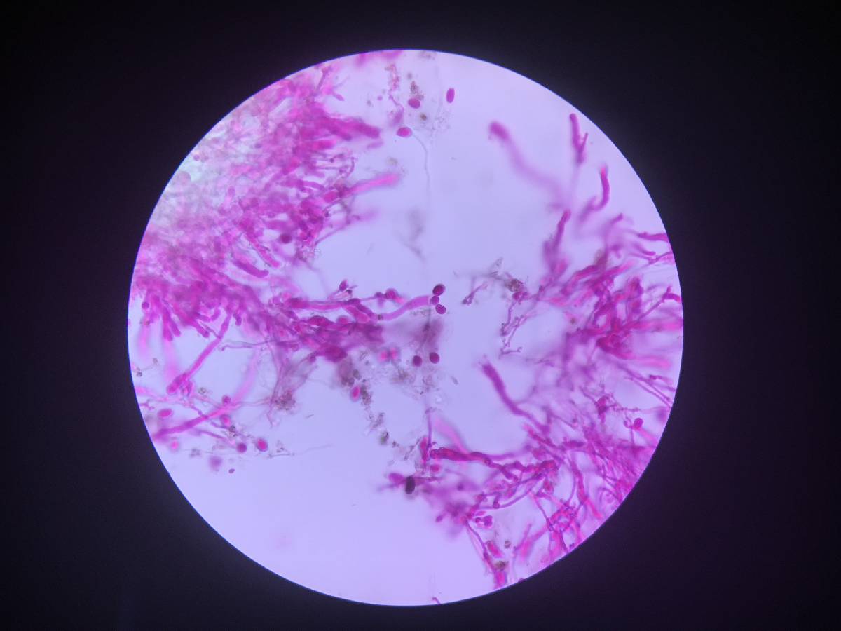 Corticium meridioroseum image
