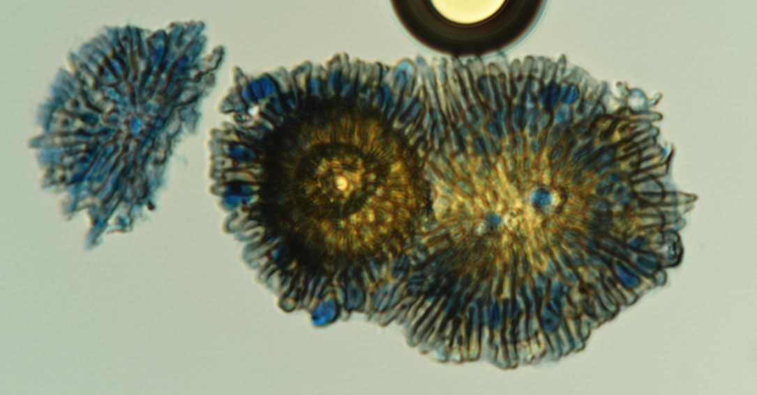 Tubakia nyssae image