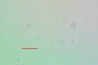 Lecanora coniferarum image