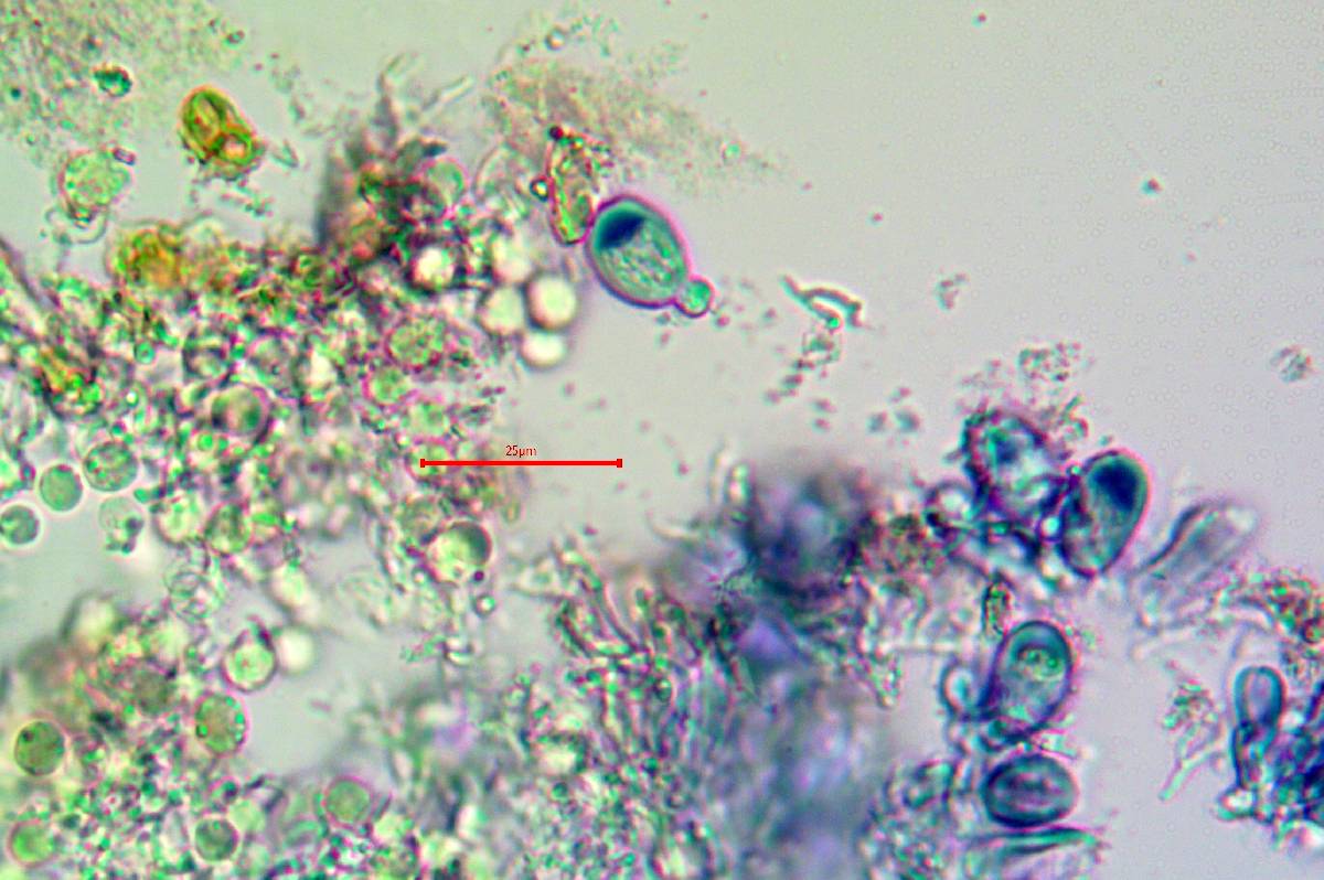 Micarea nitschkeana image