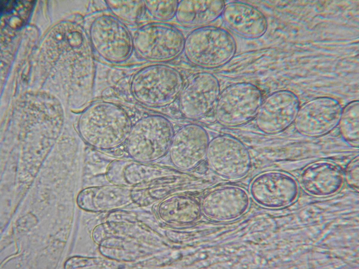 Pachyella babingtonii image