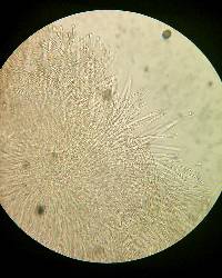 Vibrissea filisporia image