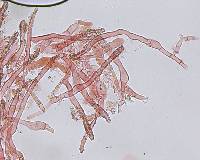 Peniophora aurantiaca image