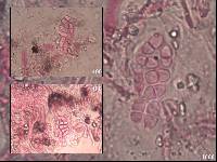 Lecania turicensis image