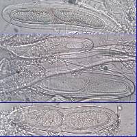 Pertusaria heterochroa image