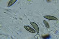 Rosellinia hyalospora image