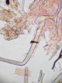 Tubulicrinis chaetophorus image