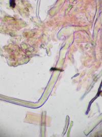 Tubulicrinis chaetophorus image