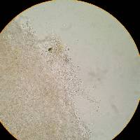 Cyphellostereum pusiolum image