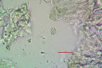 Lecanora gangaleoides image