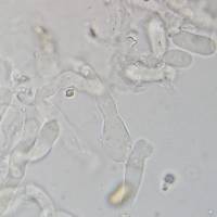 Meottomyces dissimulans image