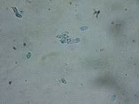 Rhodocybe caelata image