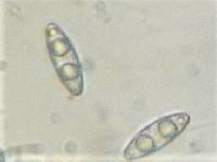 Octospora coccinea image