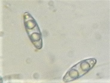 Octospora coccinea var. tetraspora image