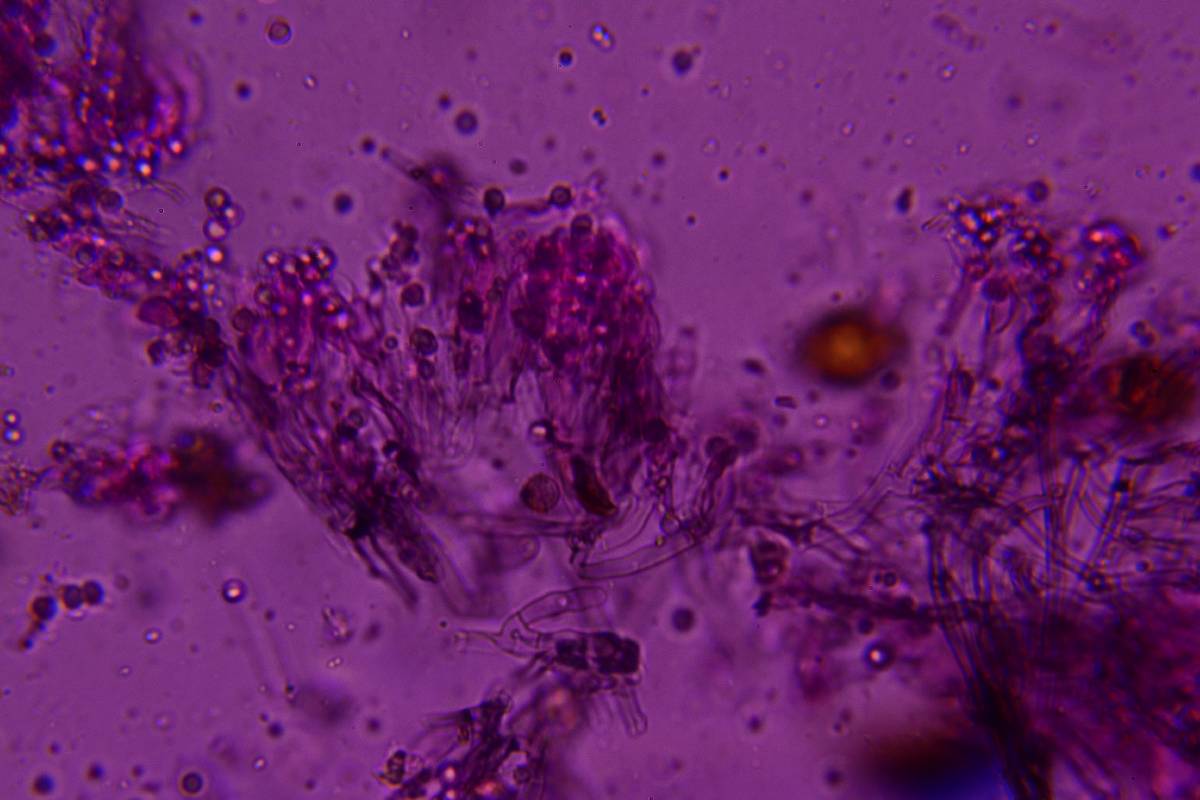 Byssocorticium caeruleum image
