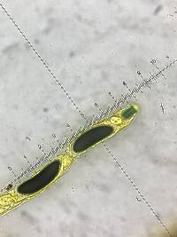 Rosellinia corticium image