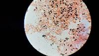 Psathyrella prona image