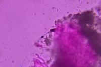 Hyphodermella rosae image