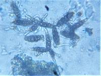 Pleomassaria siparia image