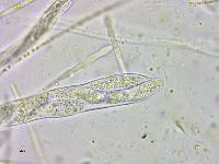 Stamnaria americana image