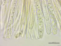 Stromatinia rapulum image