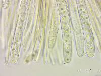 Stromatinia rapulum image