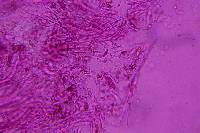 Claussenomyces olivaceus image