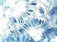 Caloplaca pyracea image