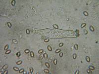 Inocybe amblyospora image