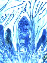 Caloplaca aurantia image